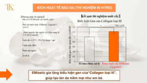 EMlastic: Kích Hoạt Nguyên Bào Sợi và Tăng Cường Sản Sinh Collagen