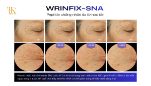 WrinFix-SNA: Hiệu quả giảm nhăn